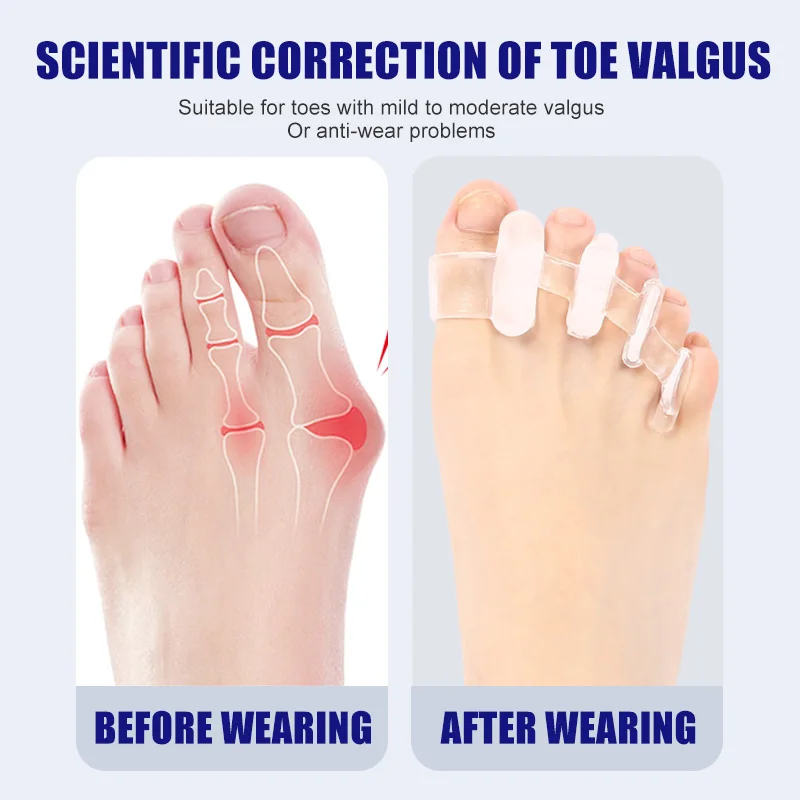 Separador de dedos de silicone - Toe Separator Silicon avaliação e preço