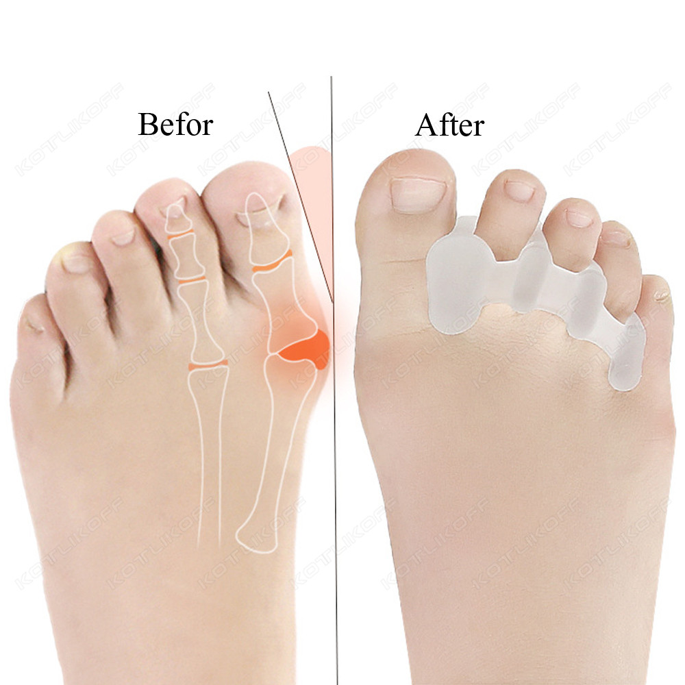 Separador protetor de dedos do - Toe Separator Silicon avaliação e preço